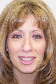 Spacing Between Teeth – Clear Aligners – Marianne W. Headshot